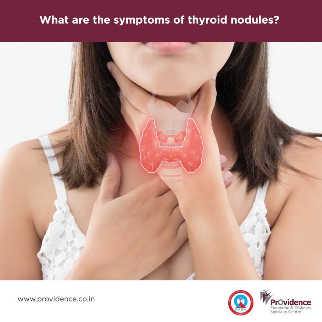 What are the Symptoms of Thyroid Nodules? | Thyroid Lump Symptoms