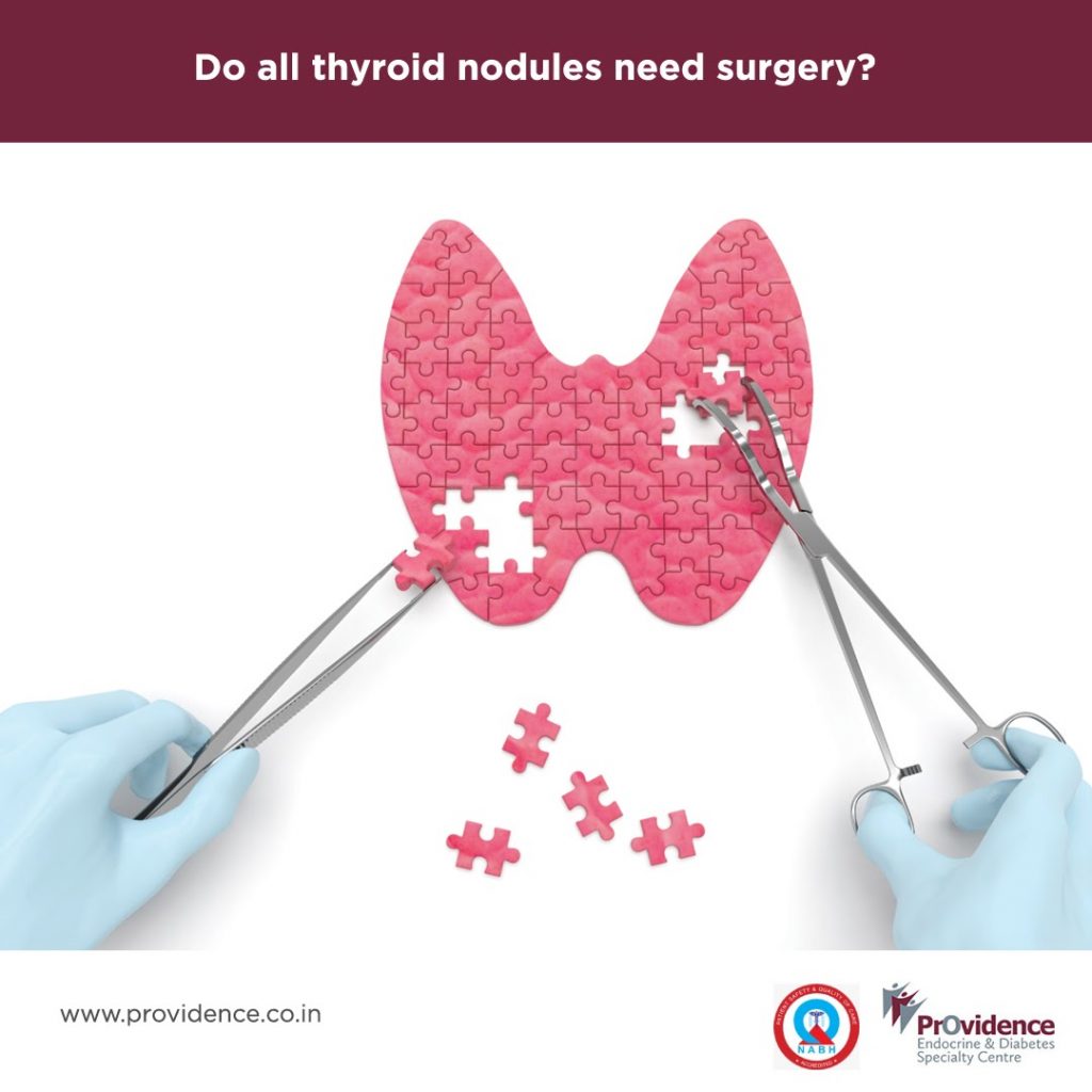 Do All Thyroid Nodules Need Surgery? | Thyroid Nodule Removal Surgery