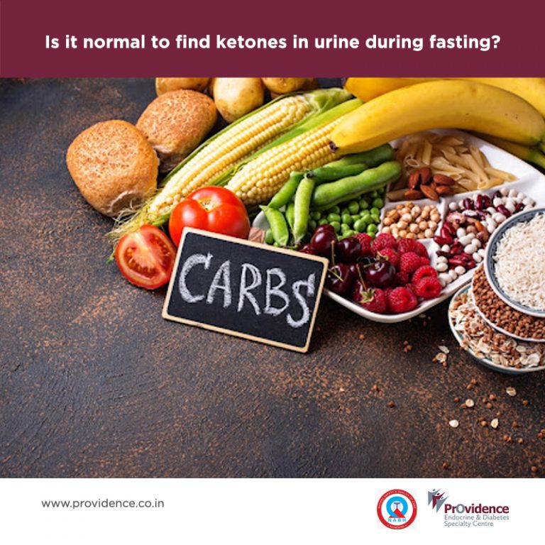 is-it-normal-to-find-ketones-in-urine-during-fasting-ketones-and-fasting