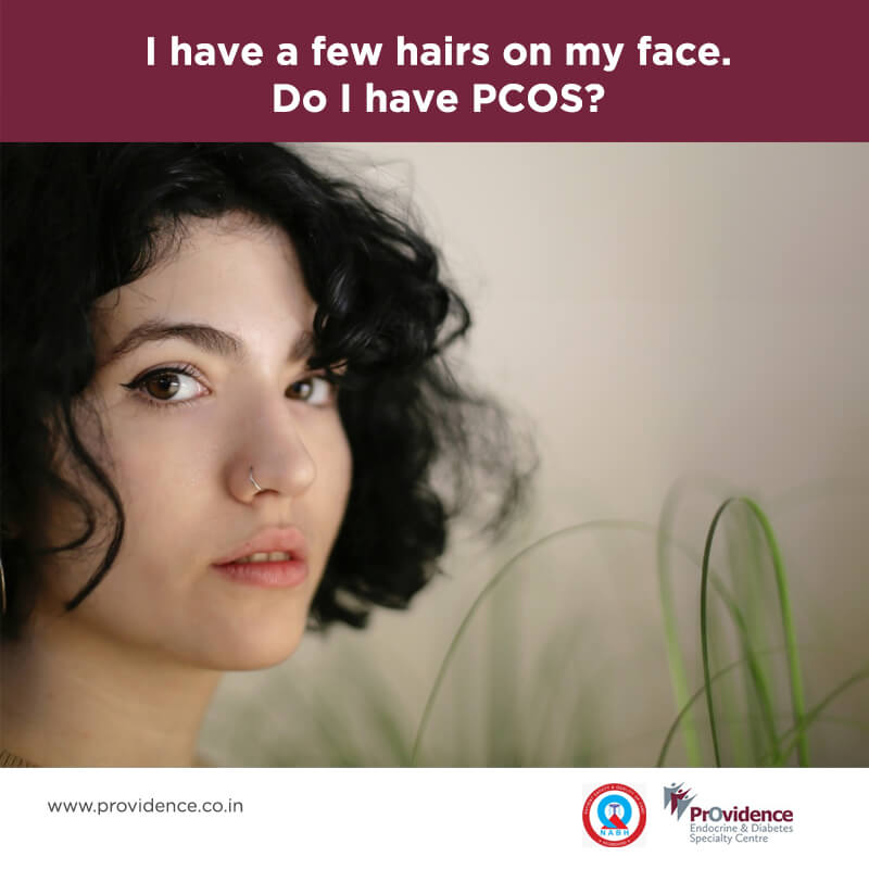 hair on face - pcos