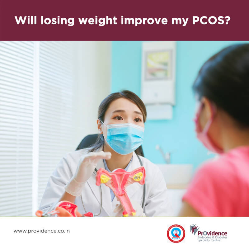 Will losing weight improve my PCOS?