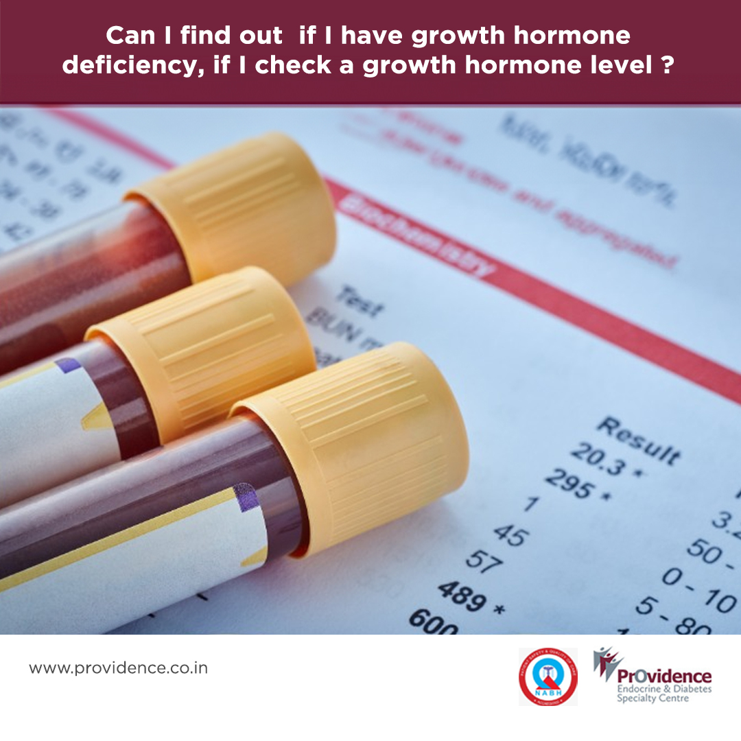 growth hormone deficiency